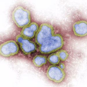 Epidemiology