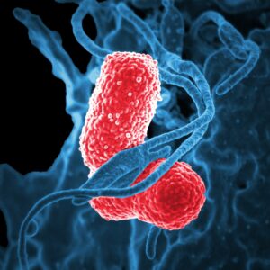 Legionella Management