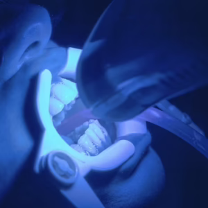 Dental Radiography