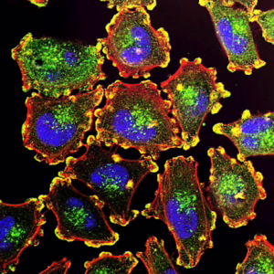 Principles of Immunology