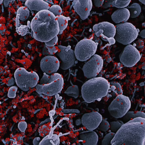 Bloodborne Pathogen Safety